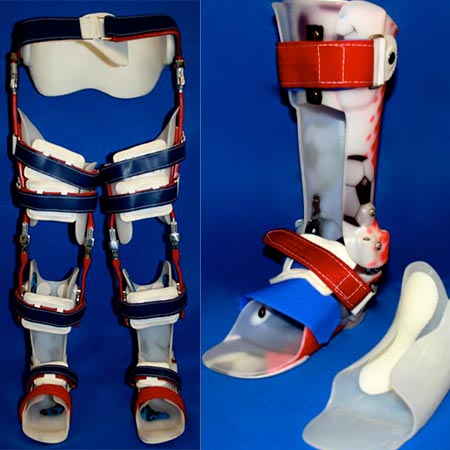 Lower Extremity Orthotic Bracing