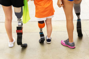 Athletes,of,different,ages,with,a,running,leg,prosthesis.,people